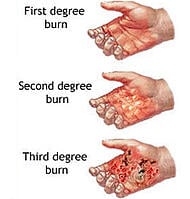 electrical safety, electrical safety training